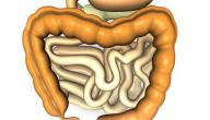 ما هو تضخم القولون صورة مقال ما هو تضخم القولون