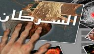 تفسير مرض السرطان في الحلم صورة مقال تفسير مرض السرطان في الحلم