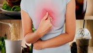 طرق علاج حموضة المعدة صورة مقال طرق علاج حموضة المعدة