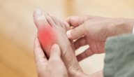 أعراض النقرس صورة مقال أعراض النقرس