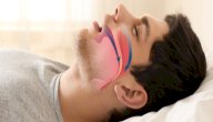 أسباب الاختناق أثناء النوم صورة مقال أسباب الاختناق أثناء النوم