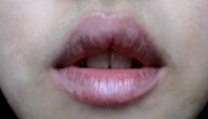 أسباب سواد الشفاه صورة مقال أسباب سواد الشفاه