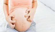 أسباب الحكة عند الحامل صورة مقال أسباب الحكة عند الحامل