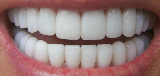 Image result for ‫الاسنان‬‎