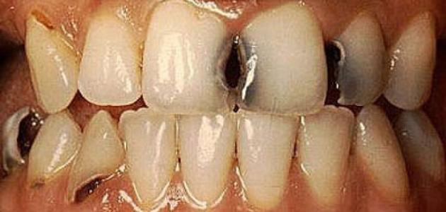 ÙØªÙØ¬Ø© Ø¨Ø­Ø« Ø§ÙØµÙØ± Ø¹Ù ØªØ³ÙØ³ Ø§ÙØ£Ø³ÙØ§Ù/ÙØ®Ø± Ø§ÙØ£Ø³ÙØ§Ù