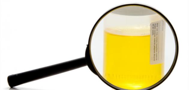 أعراض عدوى المسالك البولية الفتيات