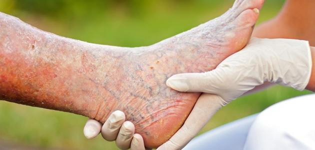 ���� �������