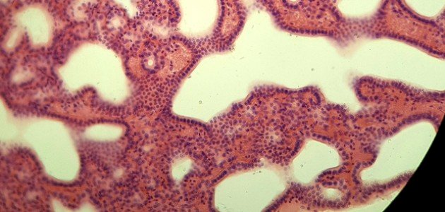 تعريف الأنسجة الطلائية الانتقالية صورة مقال تعريف الأنسجة الطلائية الانتقالية