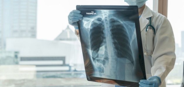 صورة مقال خاتمة بحث عن الأشعة السينية
