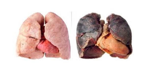 ØµÙØ±Ø© Ø°Ø§Øª ØµÙØ©