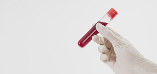 رجيم فصيلة الدم