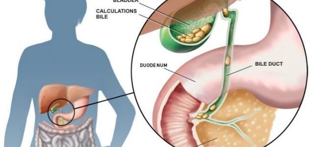 نقره لعرض الصورة في صفحة مستقلة