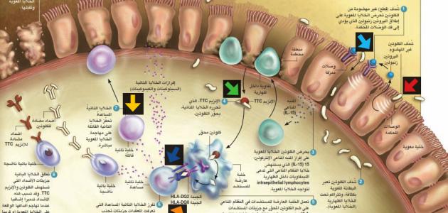 اختيار نمط الاستجابة المناعية اختيار نمط الاستجابة المناعية
